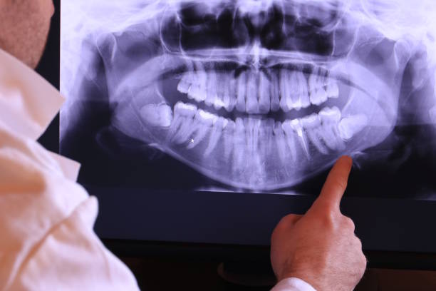 Best Weekend Emergency Dentist in Scotts Valley, CA