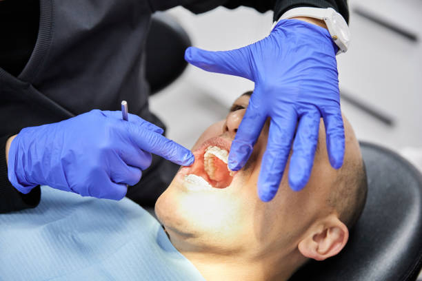 Best Pediatric Emergency Dentist in Scotts Valley, CA